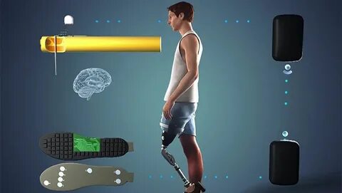 Una pierna protésica con neurofeedback hace que caminar s.