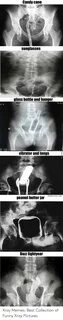 🐣 25+ Best Memes About Funny Xray Pictures Funny Xray Pictur