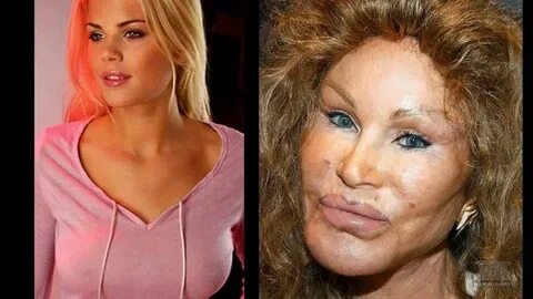 10 Celebrity Before-And-After Plastic Surgery Disasters Cele