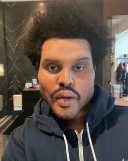 Внешний вид рэпера The Weeknd после операции удивил интернет