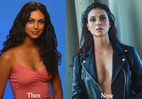 Morena Baccarin Plastic Surgery Before and After - Are Her B