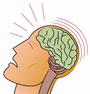 traumatic brain injury data - Clip Art Library