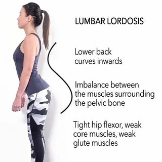 How to Improve Bad Posture & Look Tall - Exercises & Causes