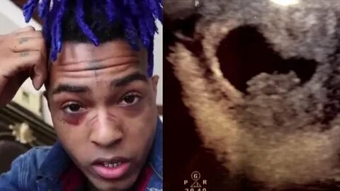 Mother of XXXTentacion Reveals 20-Year-Old Rapper Had Baby o