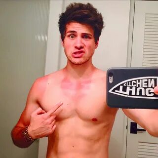 JAY on Twitter: ""@smoshanthony: Haha the sunburn looks way 