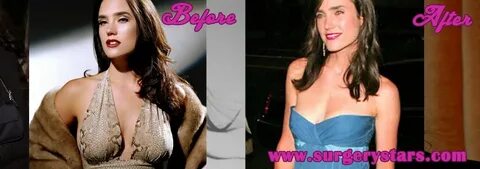 Jennifer Connelly's Breast Reduction Pics And More