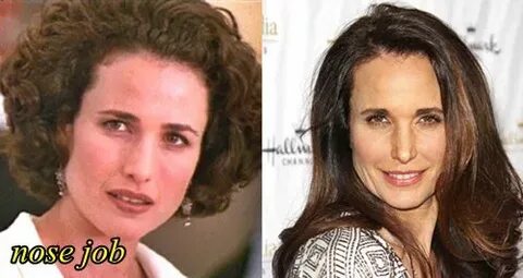 Andie MacDowell Plastic Surgery Before and After - Plastic S