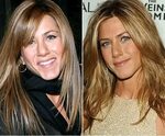 Celebrity Nose Jobs: Before and After Jennifer aniston plast