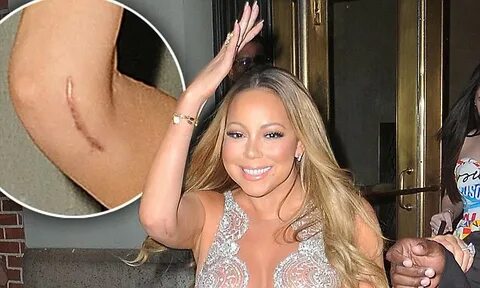 Mariah Carey reveals large scar at the New York GLAAD Media 
