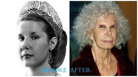 Duchess of Alba plastic surgery