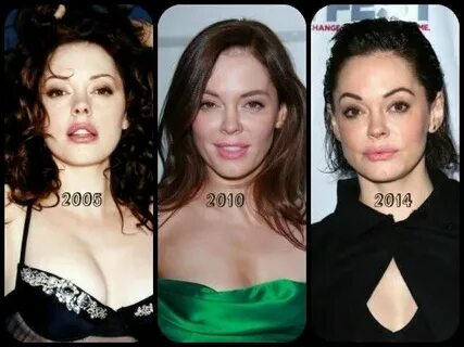 Rose McGowan - Busting The Plastic Surgery Rumours herintere
