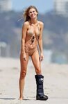Brandi Glanville Showed Up In Bikini With A Broken Leg - Cel