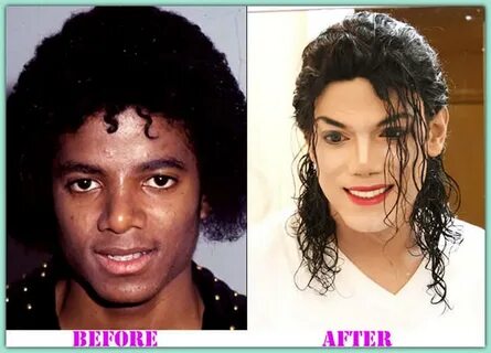 Michael Jackson Before And After Plastic Surgery - Plastic I