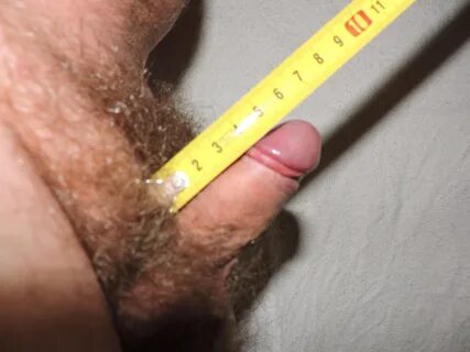 File:Measuring a micropenis closeup.JPG - Wikimedia Commons
