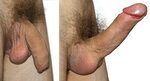 Сурет:Comparison of flaccid and erect penis.jpg - Уикипедия