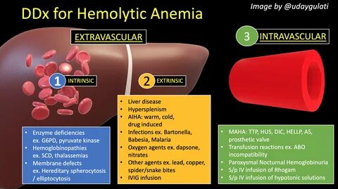 Hemolytic Anemia Liver Disease - Captions Todays