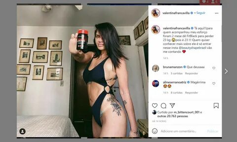 Valentina do ratinho 🍓 Oque Houve com a Valentina do Ratinho? Excesso de procedi