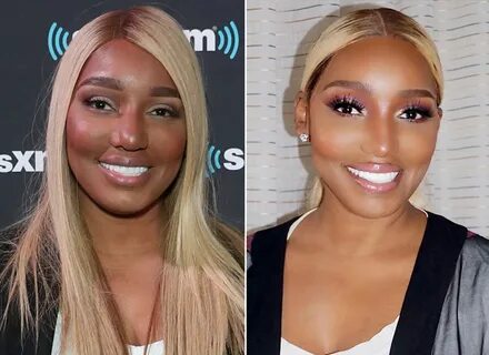 NeNe Leakes Mocked After Posting Pic That Looks Like A Photo