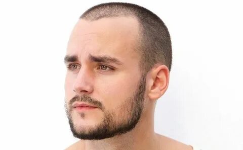 How to Effectively Fix a Patchy Beard (Bald Spot) - Beardoho