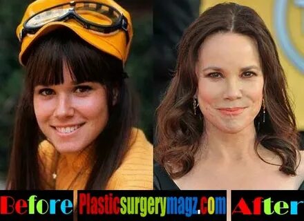 Barbara Hershey Plastic Surgery Before and After Plastic Sur