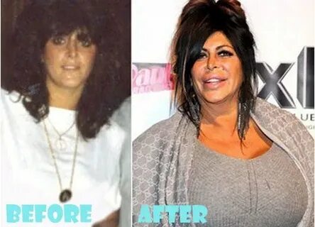 Big Ang Plastic Surgery Before and After Pictures Plastic su