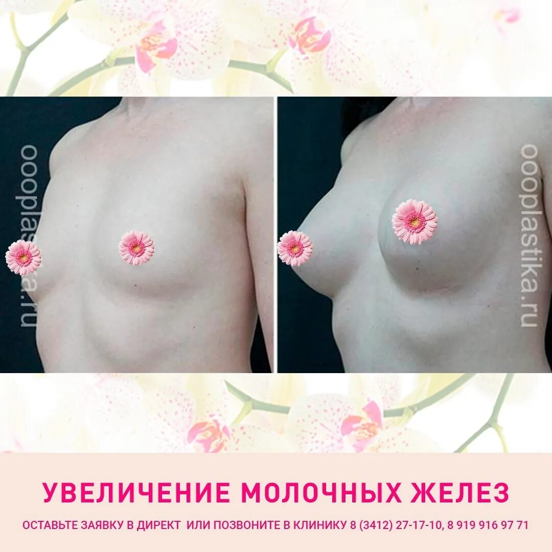 массаж для увеличении грудью фото 105