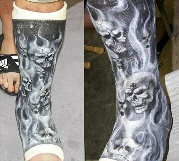 These 15 Brilliantly Decorated Casts Were Well worth the Bro
