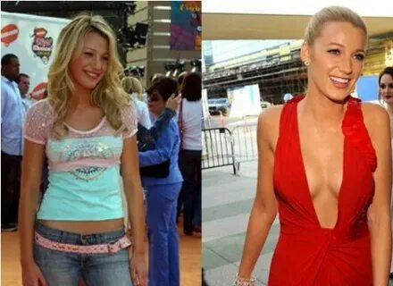 Blake Lively Breast Implants Rumor - Before and After - Cele