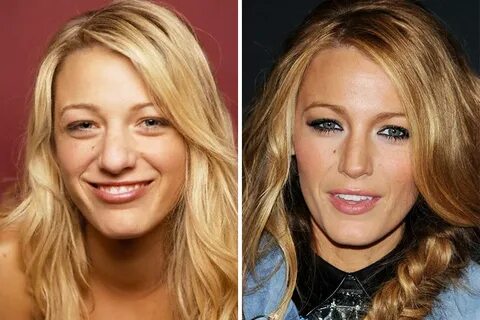 Top 21 Celebrity Nose Job Before and After Photos - Page 15 