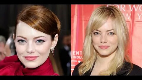 Emma Stone Plastic Surgery Before and After - YouTube