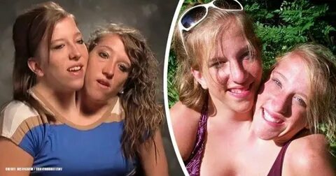 Worldwide Famous Conjoined Twins Opened Up About Their Love 