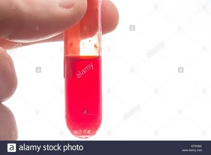 Vial of blood hi-res stock photography and images - Alamy