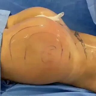 plastic__surgery_miami (@plastic__surgery_miami) — Instagram