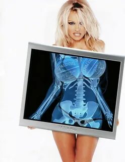 Рентгеновские снимки девушек (75 фото) - порно фото