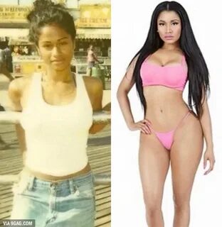 Nicki Minaj Before and After Plastic Surgery / 9gag / funny 