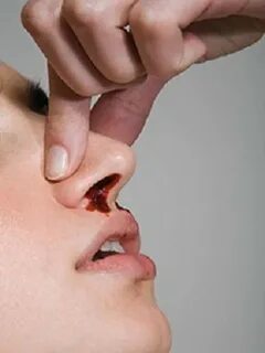 Кровь из носа: почему при простуде и насморке появляются кро