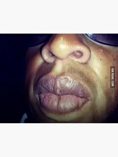 Which rapper got the sexiest lips KTT2