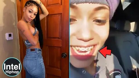 Coi leray can’t put food in her mouth 👄 because of her new braces 😬 - You...