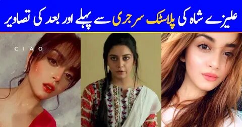 Alizeh Shah's Pictures Before And After Plastic Surgery Revi