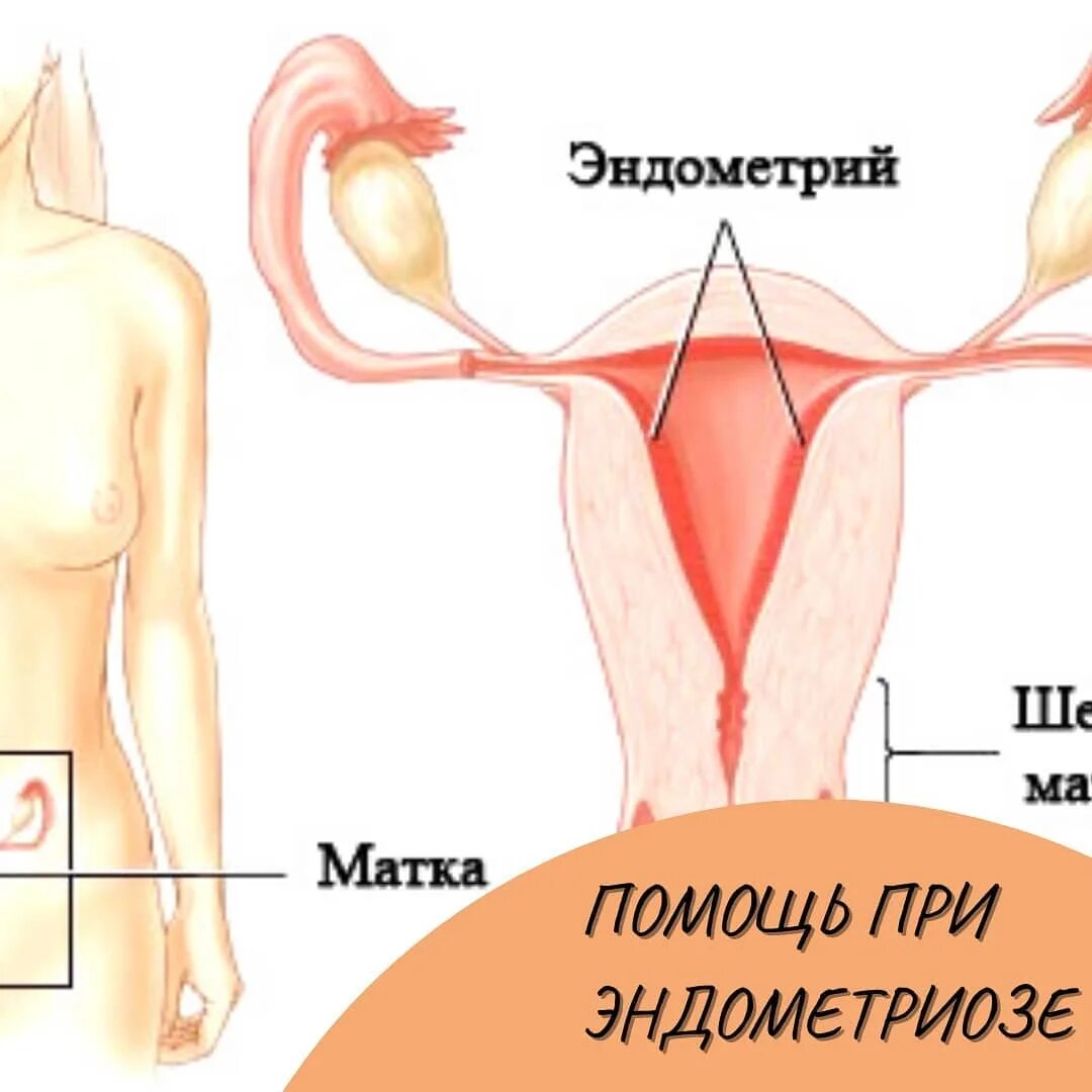 оргазм при миоме матки фото 105