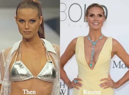 heidi-klum-breast-augmentation-before-and-after - Latest Pla