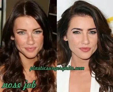 Jacqueline Macinnes Wood Plastic Surgery Jacqueline macinnes