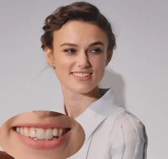 Pictures : Celebrities Who Won’t Fix Their Teeth - Keira Kni
