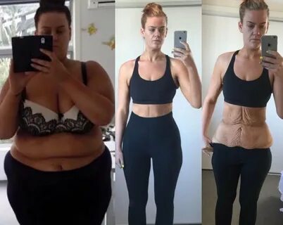 Woman accused of faking weight loss pics silences critics wi