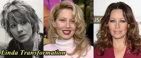 Linda Kozlowski Plastic Surgery Before and After - Plastic S