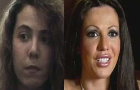 Long Island Lolita Amy Fisher plastic surgery, new face befo