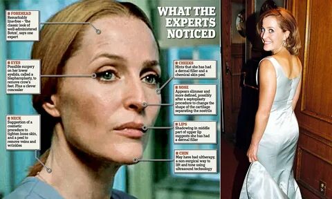 Gillian Anderson Plastic Surgery