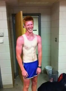 Amazing Sunburns Picdump