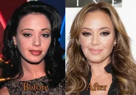 Leah Remini Plastic Surgery, Before and After Boob Job Pictu