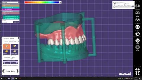 Временные съемные протезы методом 3D-печати - компания ARTIC